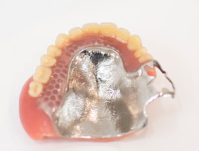 写真 コバルトクロム床義歯（総入れ歯/部分入れ歯）