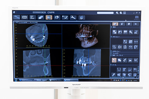 写真 歯科用CTで精確な診査・診断